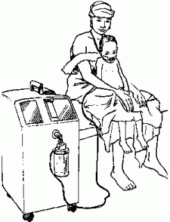 Diagram oxygen concentrator